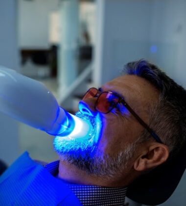 tratamientos-blanquemiento_dental-almeria